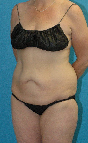 DSC_4430 3.38.36 PMcr