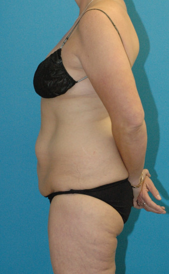 DSC_4432 3.38.36 PMcr