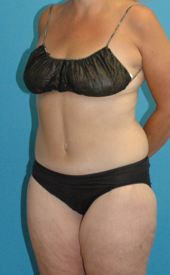 DSC_4715 3.52.35 PMcr