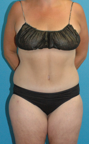 DSC_4713 3.52.35 PMcr