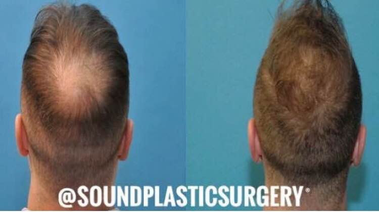 Office Reception Area Image