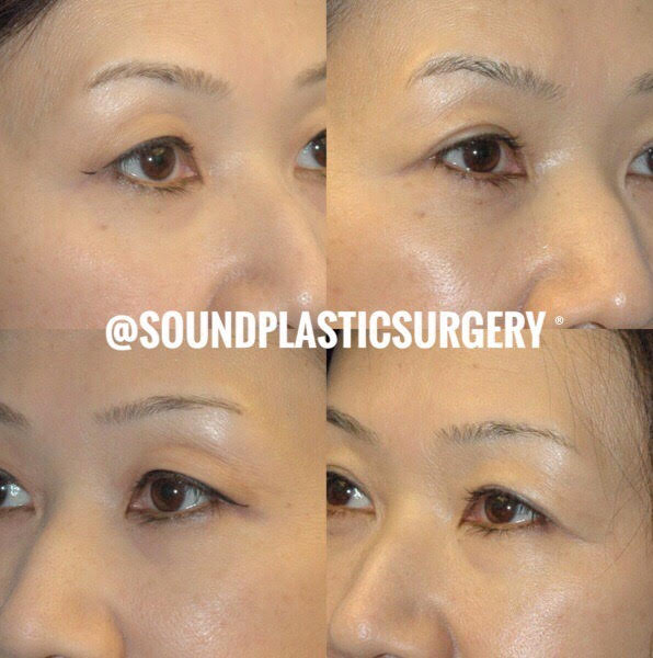 Office Reception Area Image