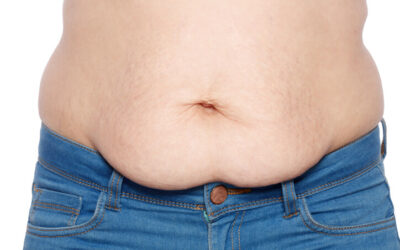 Benefits of a Tummy Tuck