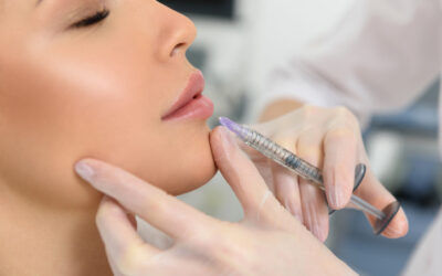 Lip Fillers