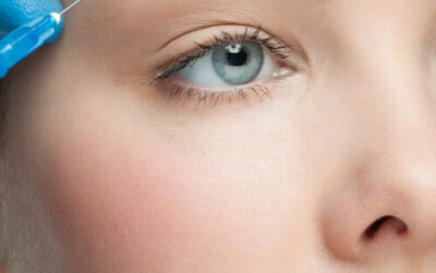 Eyebrow Lift with Botox