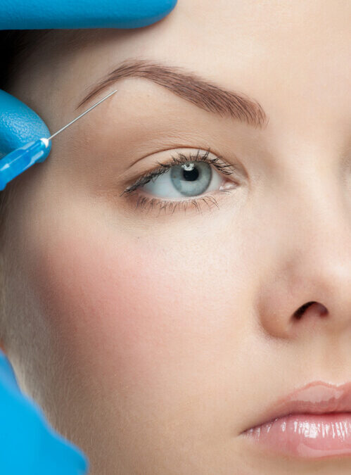 Eyebrow Lift with Botox