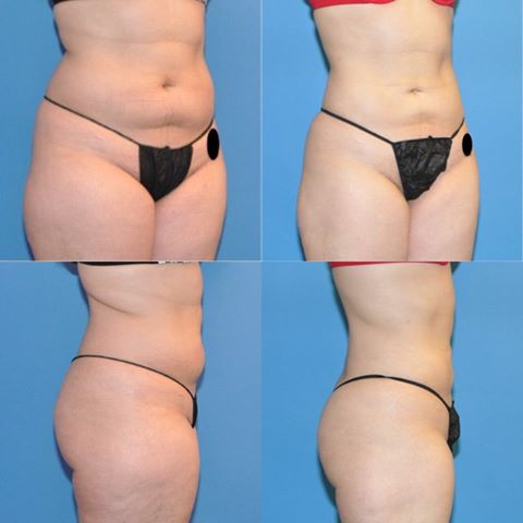 Office Reception Area Image