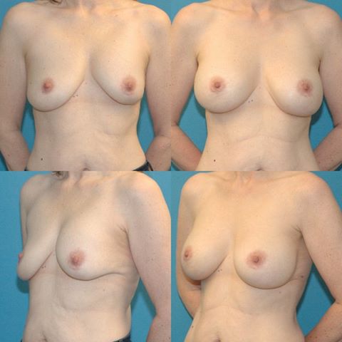 Office Reception Area Image