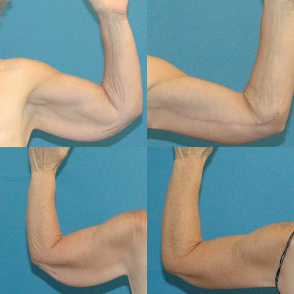 Office Reception Area Image