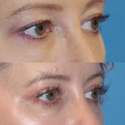 Office Reception Area Image