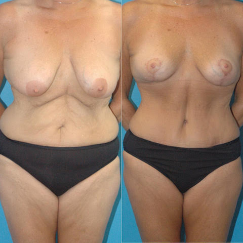 Office Reception Area Image