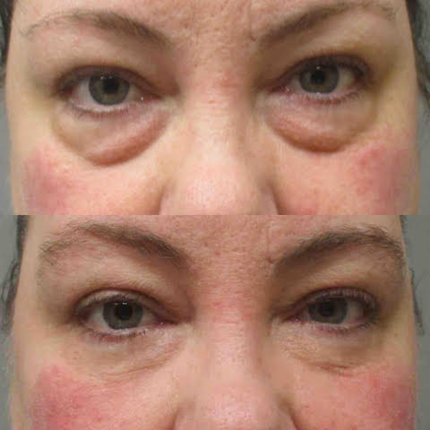 Office Reception Area Image