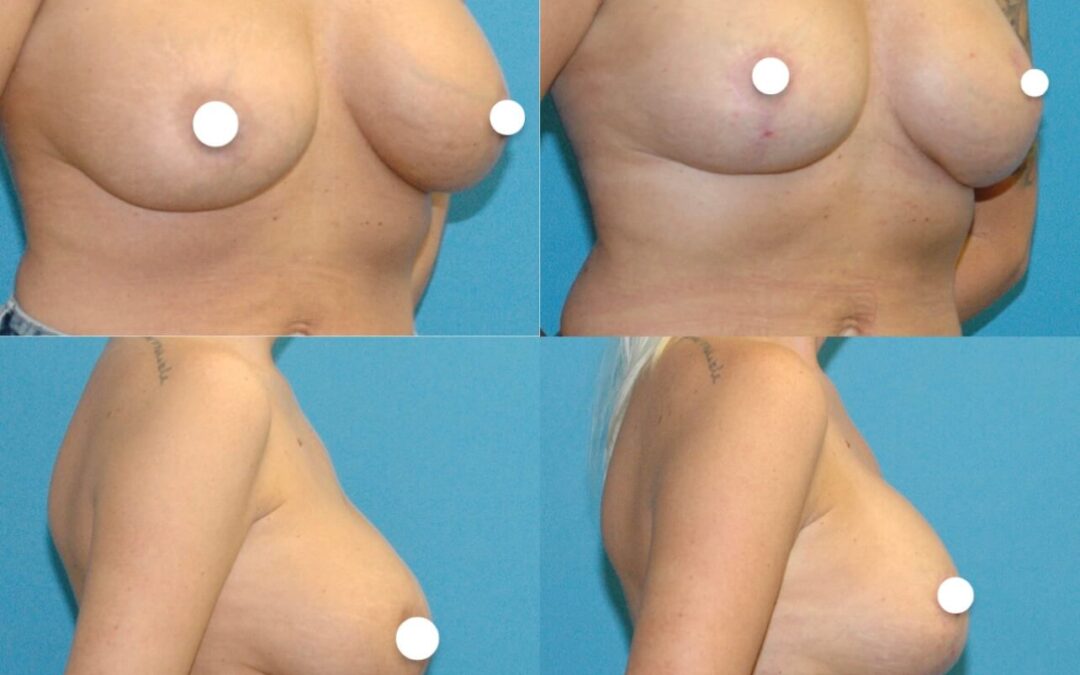 Natural and Amazing Results