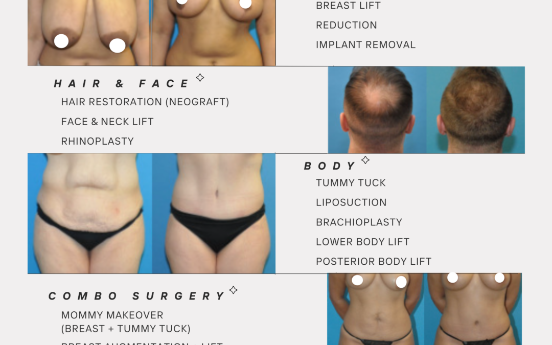 Summer Special – 20% off any Surgery!