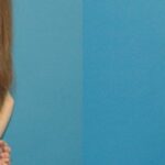 Breast Augmentation with Breast Implants #113 - Before and After