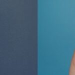 Breast Implant #19 - Before and After