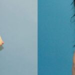 Breast Implant #33 - Before and After