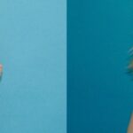 Breast Implant #73 - Before and After