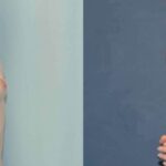 Breast Implant #83 - Before and After