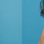 Breast Implant #84 - Before and After