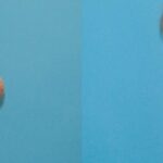 Breast Implant #95 - Before and After