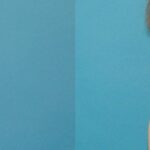 Breast Implant #98 - Before and After