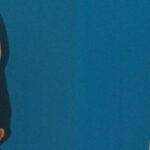 Breast Implant Revision #1 - Before and After