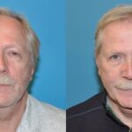 FUE NeoGraft Hair Transplant #1 - Before and After