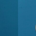 Liposuction #2 - Before and After