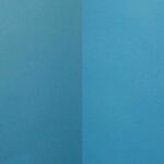 Liposuction #5 - Before and After