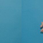 Tummy Tuck #24 - Before and After