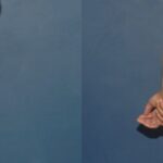 Tummy Tuck #33 - Before and After