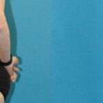 Tummy Tuck #48 - Before and After