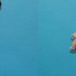 Tummy Tuck #52 - Before and After