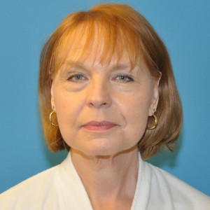 facial surgery after image