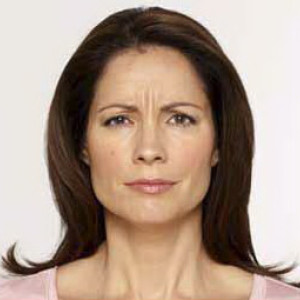 5e4f1c0d12d0d facial surgery before image