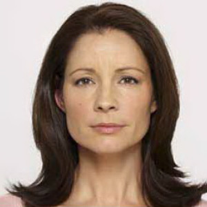 5e4f1c0e7d3c4 facial surgery after image