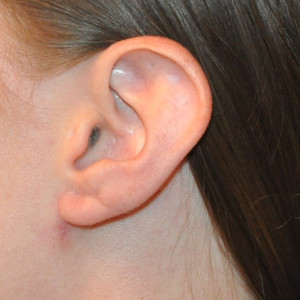 5e50697f9b2d6 facial surgery after image