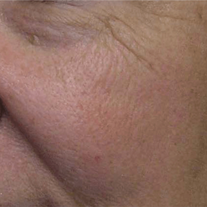 facial surgery before image