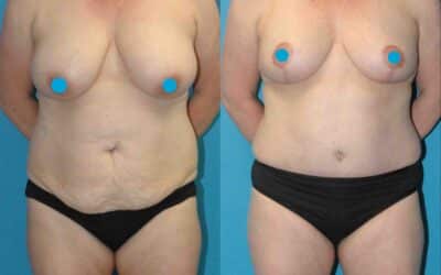 Marvelous Mommy Makeover!