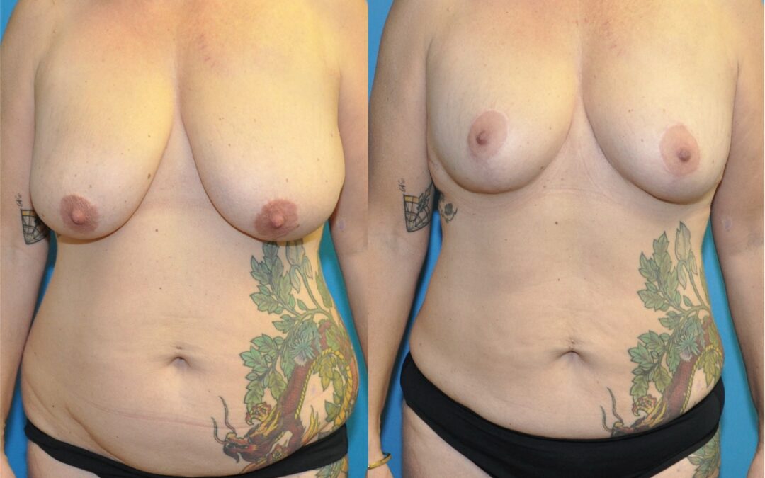 Spectacular Reduction Results!